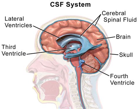 csf leak from nose test|CSF Leak Diagnosis 